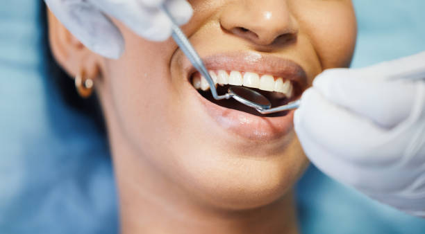 Best Emergency Dental Extractions in Lemont, IL